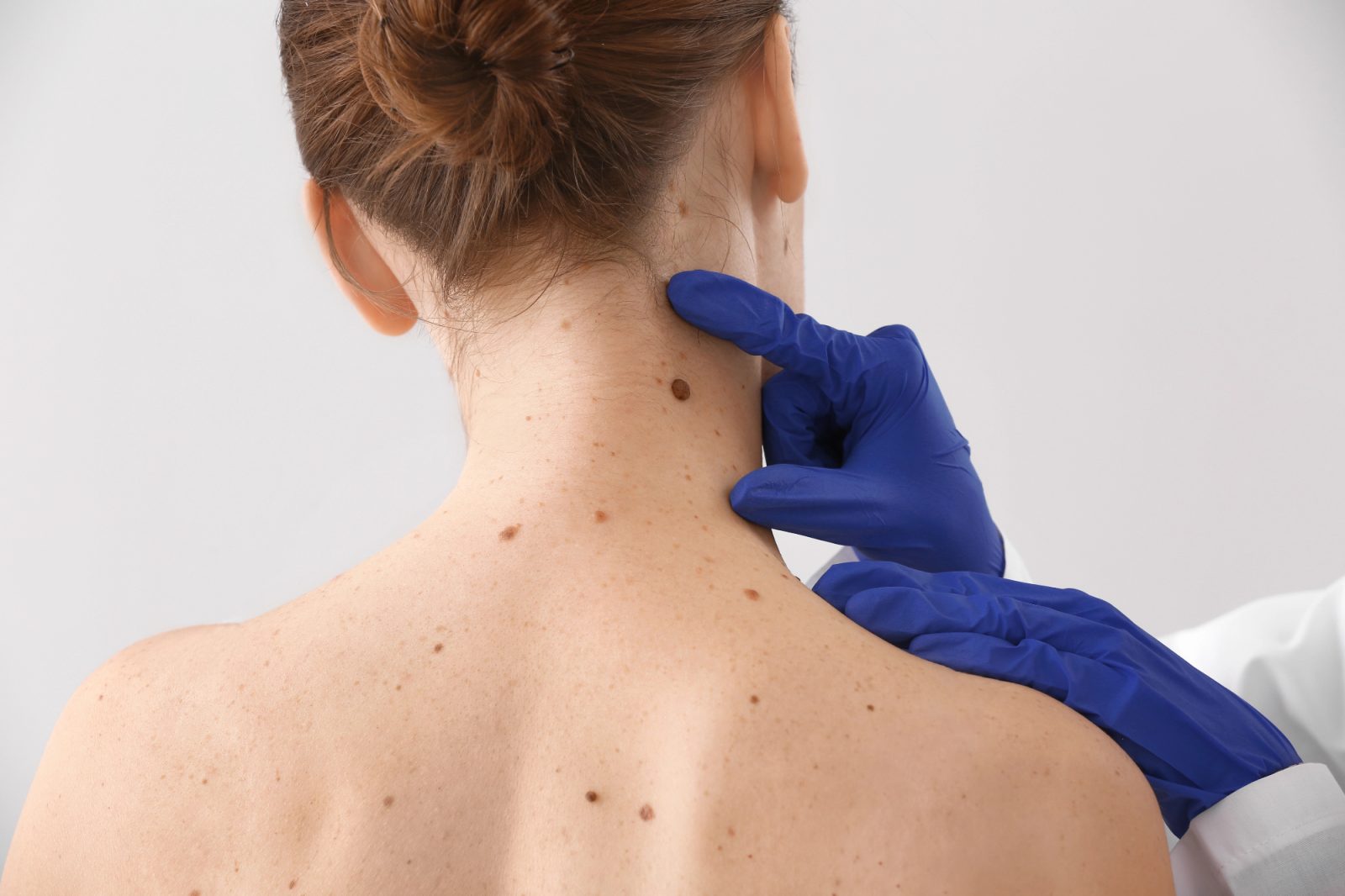 Dermatologija Ljubljana mi je ustvarila pozitiven vtis